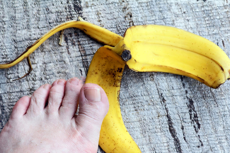 forih wonderful uses of banana peel for your body 4